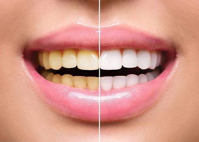 Dental wellness illustration